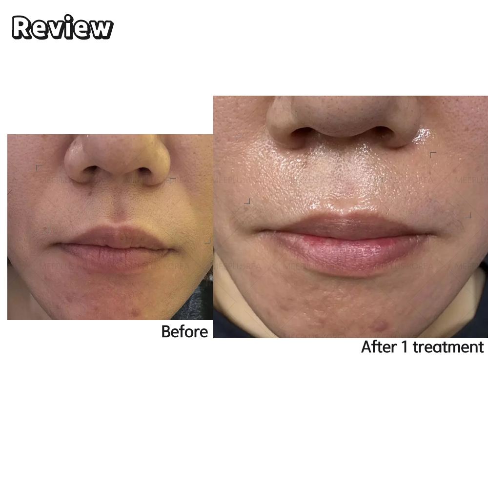skin lifting peptide serum Collagen Boosting Advanced Lifting Skin Firming Anti Wrinkle Moisturizer