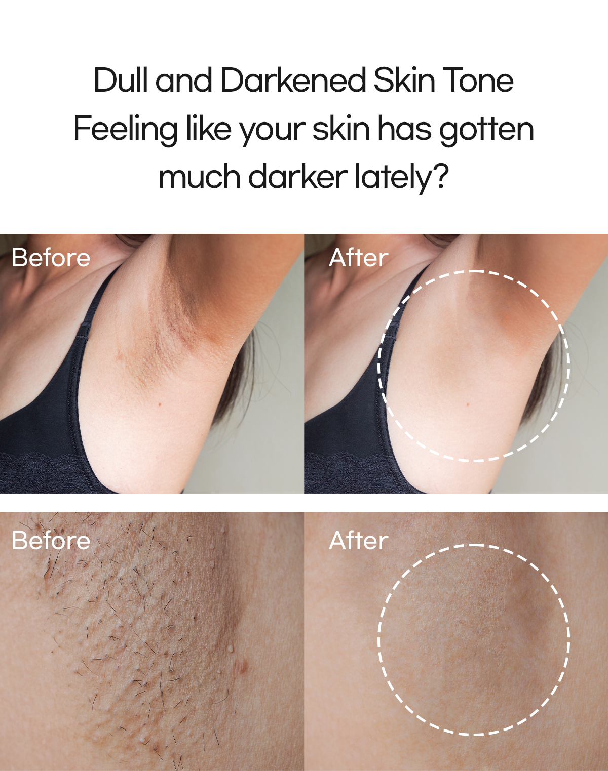 Blue Petal Dark Spot Corrector with Tranexamic Acid &amp; Niacinamide 30ml Repair Whitening Serum for Women Adults