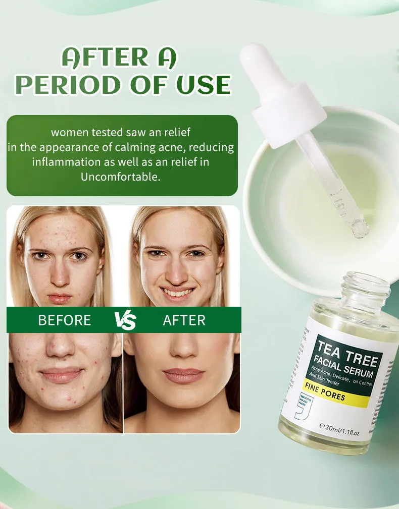 Private Label Facial Skin Care Acne Removal Oil Control Whitening Hydration Tea Tree Facial Serum