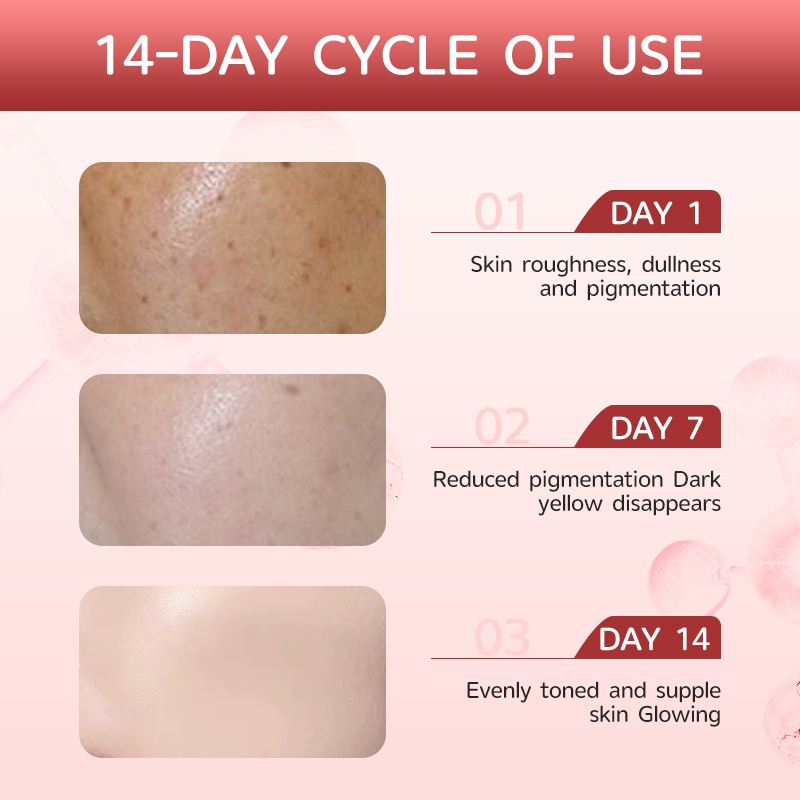 Korean OEM Hyaluronic Acid Niacinamide 10% + TXA 4% Dark Spot Serum Hyperpigmentation Correcting Brightening Serum