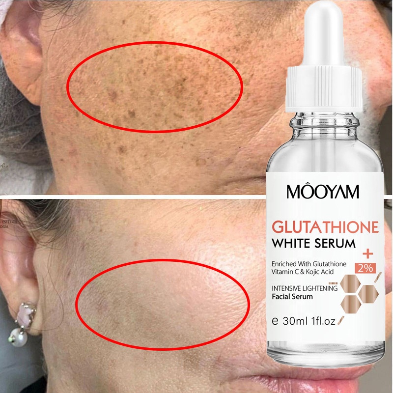 Private Label Vitamin C Kojic Acid Skincare Glutathione Serum Skin Whitening Facial Serum for Dark Spots Remover
