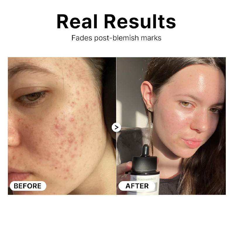 Private Label Niacinamide Face Serum Moisturizing Pore Minimizer Serum for Facial Even Skin Tone Korean Skin Care Products