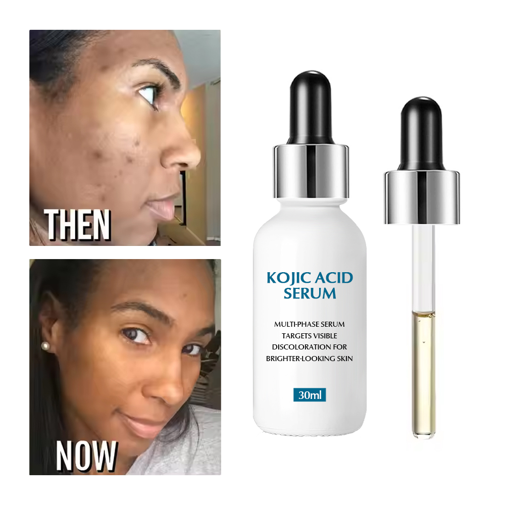 Private Label Freckle Lightening Skincare Korean Face Whitening Whiting Dark Spot Removal Remover Corrector Kojic Acid Serum