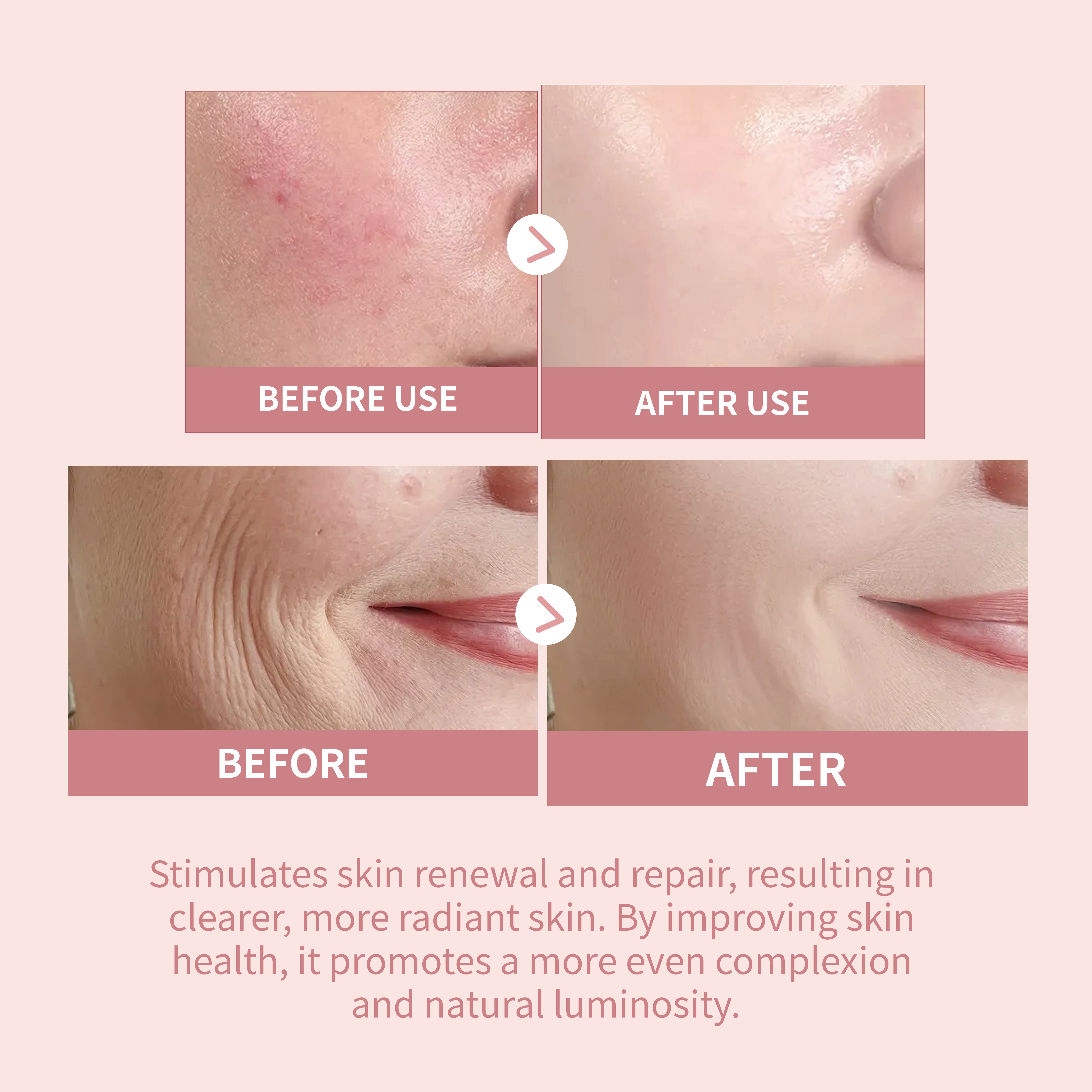 PDRN Salmon DNA Ampoule for Professional Salon Skin Repair, Collagen Boosting &amp; Wrinkle Smoothing, Derm-Clinic Grade Serum