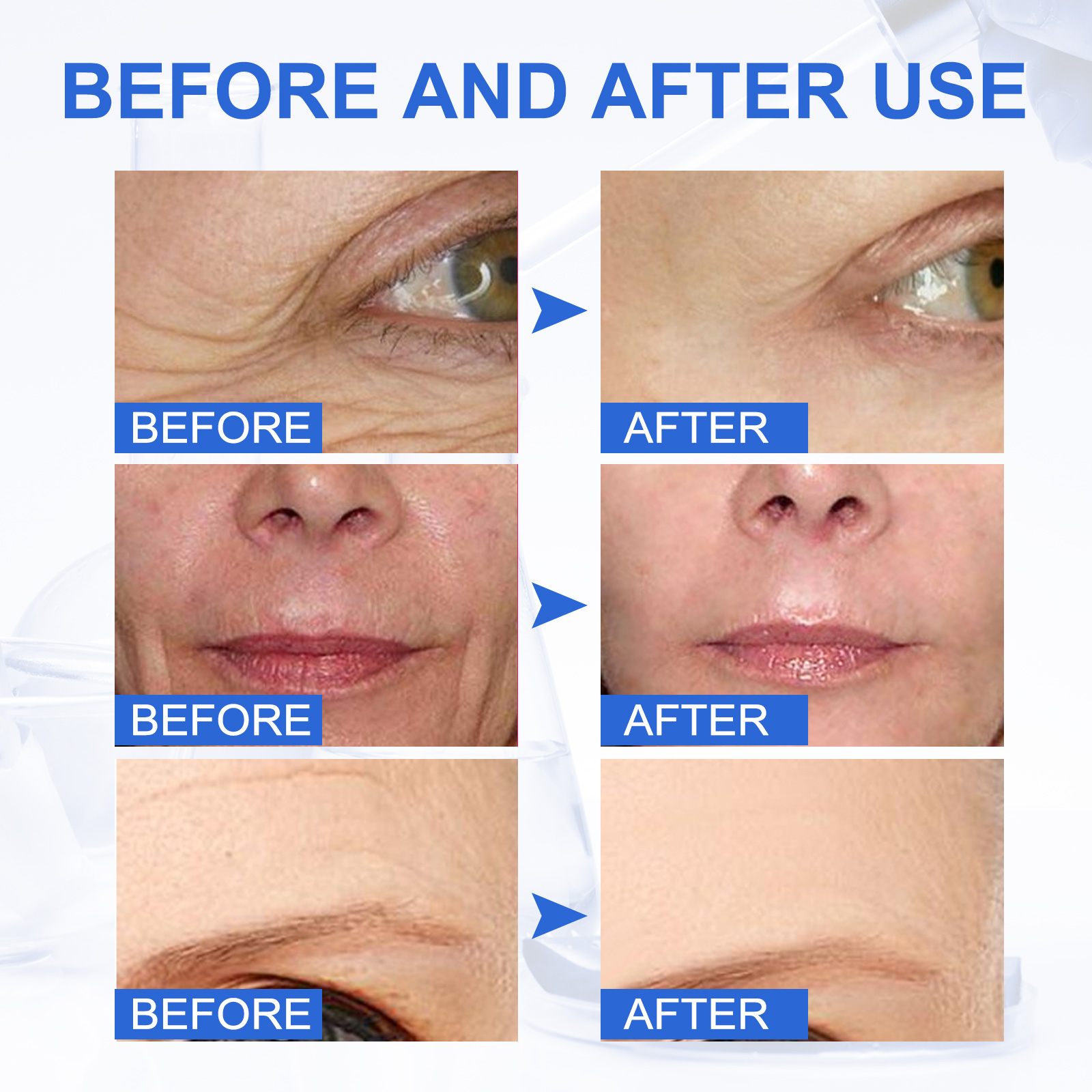 Solution Lightens Skin Fine Lines Young Again Anti-Wrinkle Stock Solution Anti Aging Face Serum for Face Dark Spots