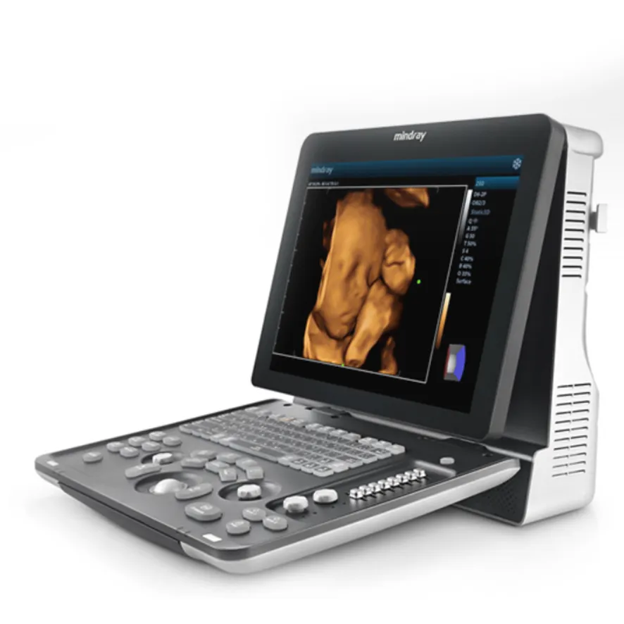 Ultrasound Scanner 1