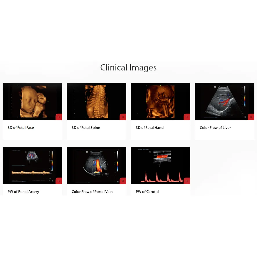 Ultrasound Scanner 3