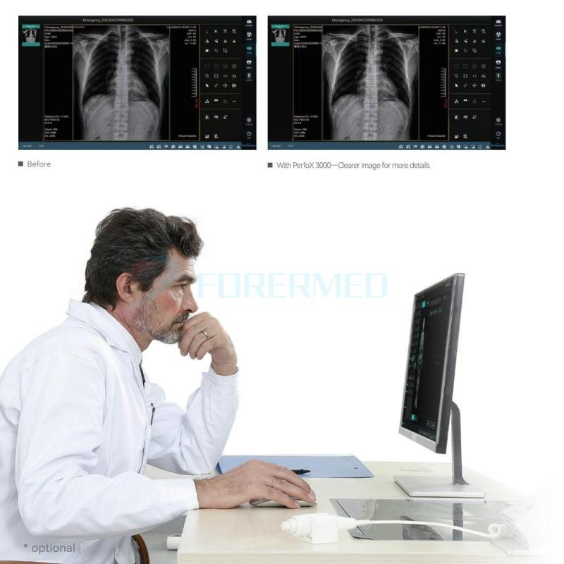 32kw Digital Floor-Mounted Radiography System Dr Flat Panel Detector