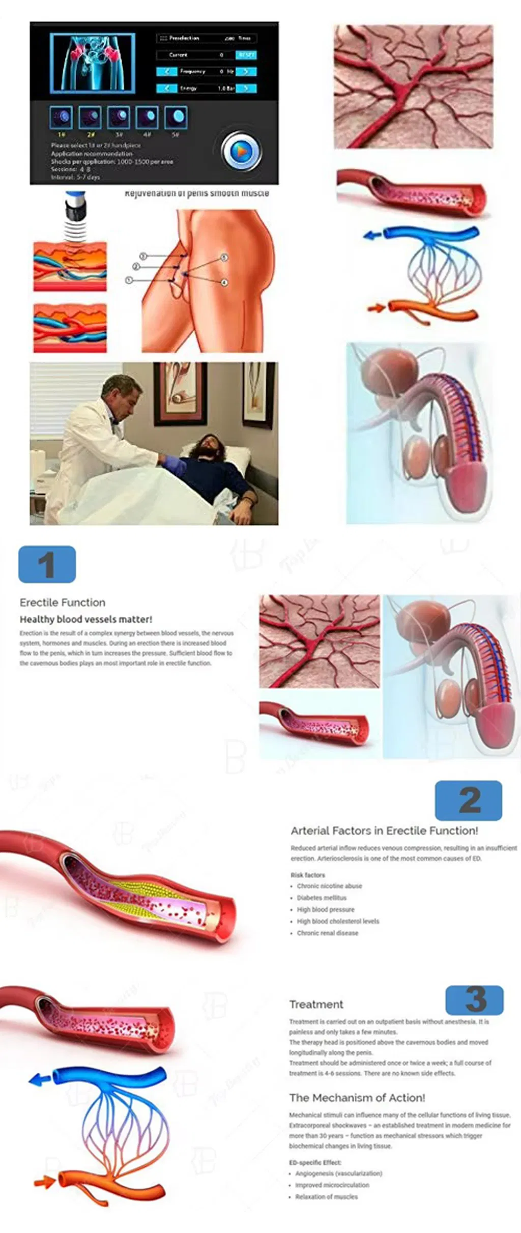 Shockwave Therapy Application