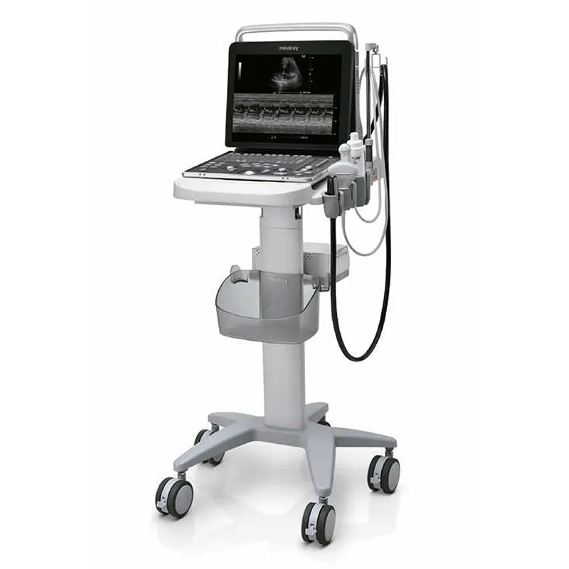 Ultrasound System 1