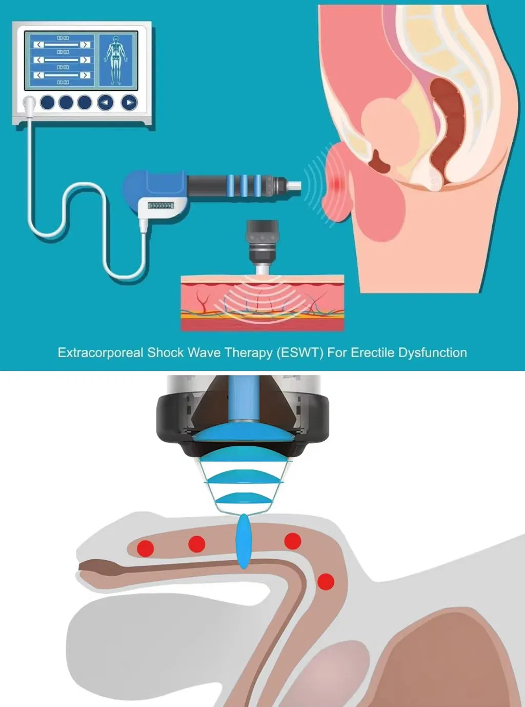 ED Treatment Mechanism