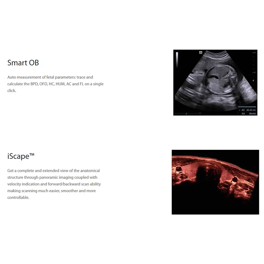 Ultrasound Scanner 5