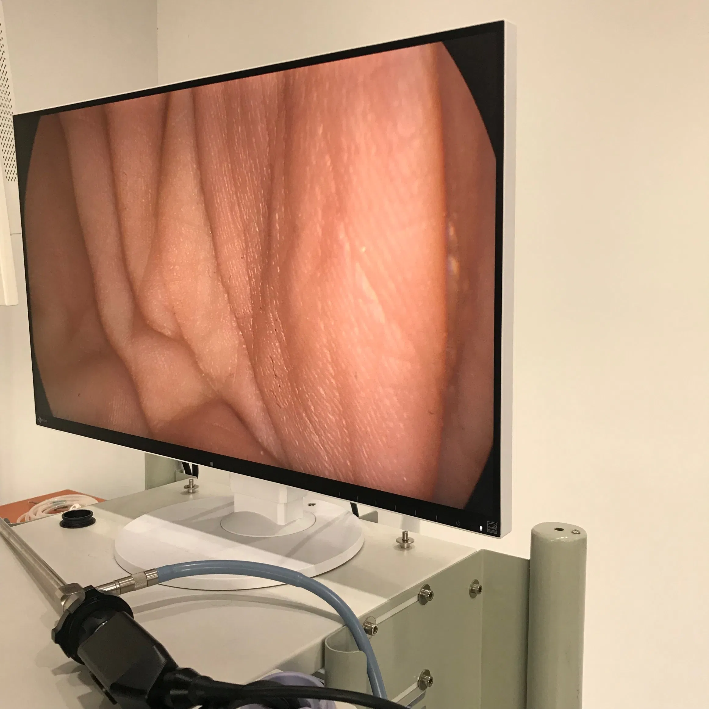 Hot Selling 50 or 60 Hz Surgery Instruments 1080P Full HD Endoscopic Imaging System