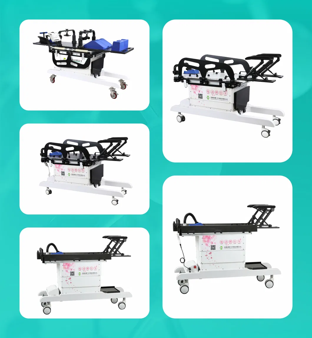 Brachytherapy Positioning 3