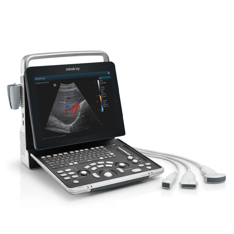 Ultrasound System 3