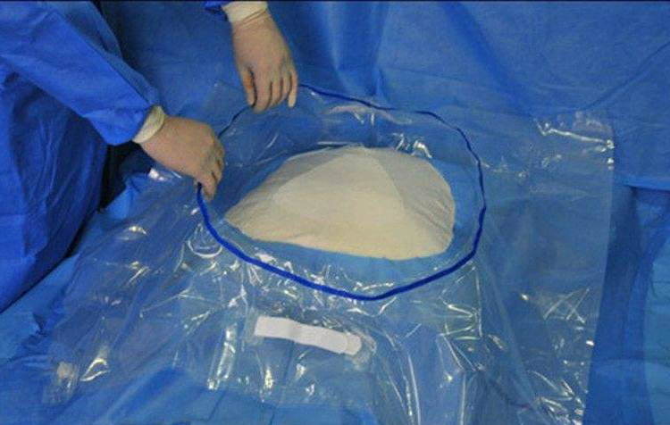 Disposable Sterile C-Section Surgical Drape