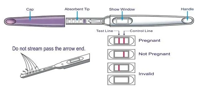 Procedure Diagram