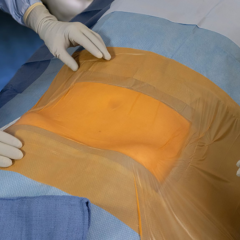 CE Approved Urgical PU Iodine Incise Film Disposable Surgical Drapes for Incision Protection