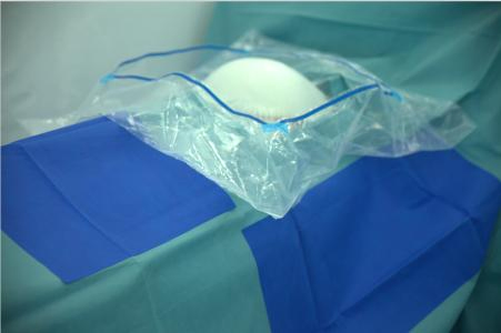 Disposable Sterile C-Section Surgical Drape
