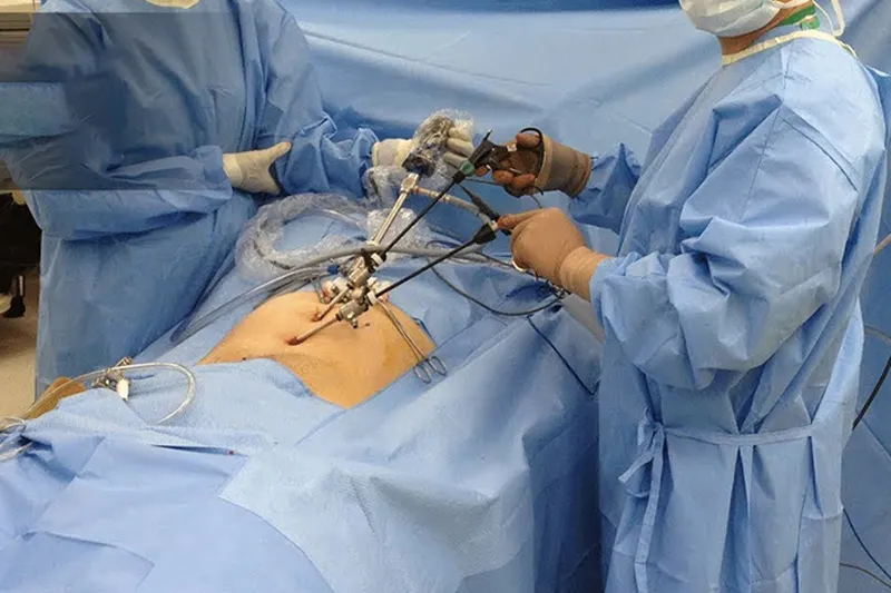 Sterile Endoscope Camera Cover 1