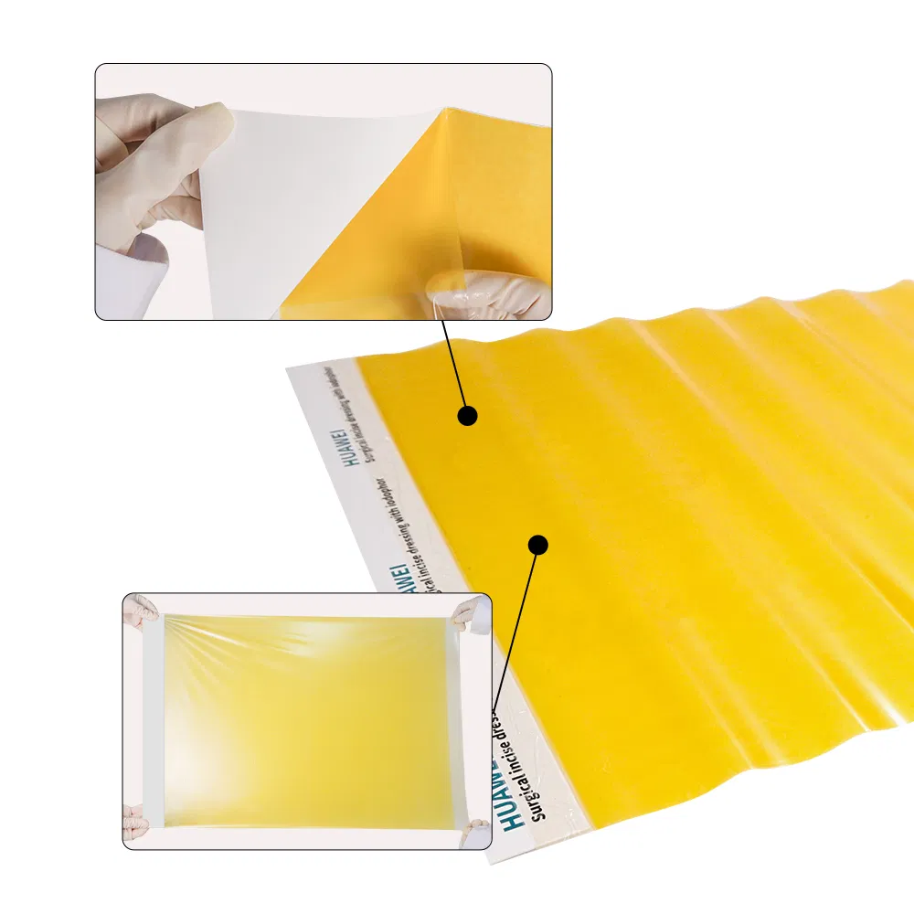 Antimicrobial Iodine Incise Drapes Steri-Drape Isolation Drape with Ioban