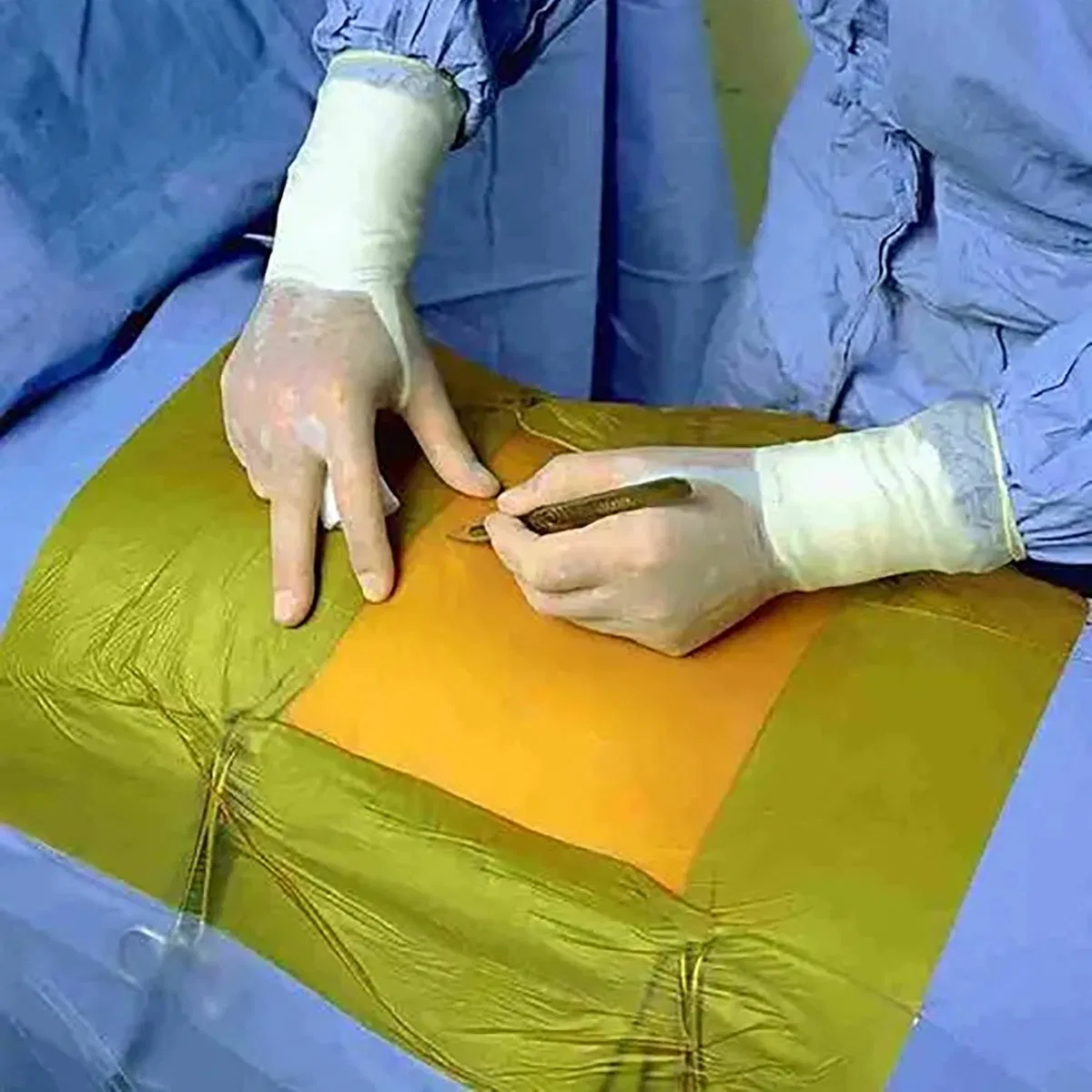CE Approved Urgical PU Iodine Incise Film Disposable Surgical Drapes for Incision Protection