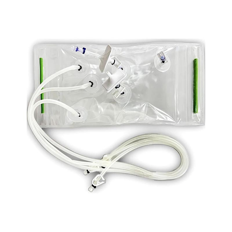 High-Capacity Single Use Bioprocess System with Customizable Bioreactor