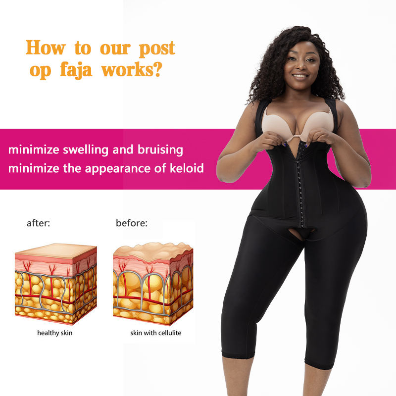 Stage 1 Bbl Colombianas Pós Cirurgia Gaine Amincissante Mulher Abdominoplastia Roupa de Compressão Tecido Elástico PARA Fajas