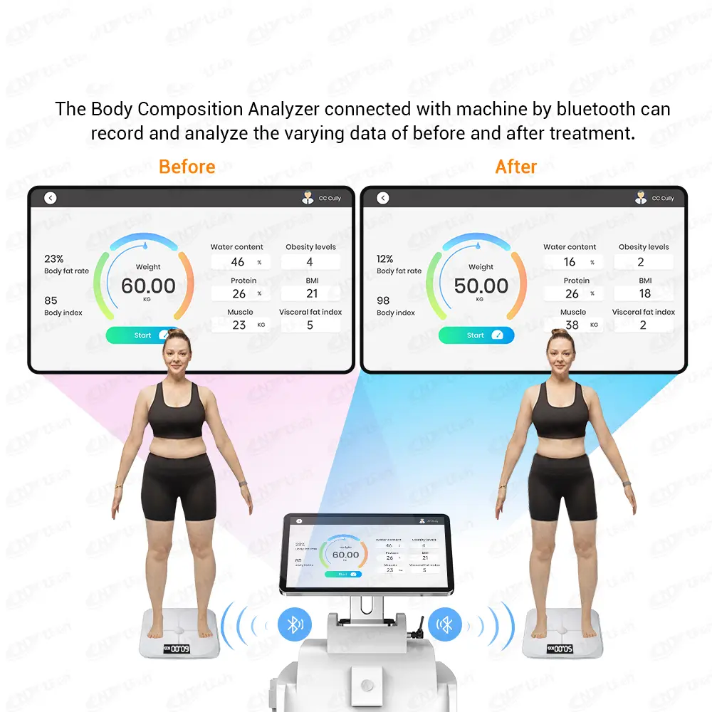 CE Certification China EMS Sculpting Muscle Building Machine - Non-Invasive Fat Reduction Solution from Reliable Suppliers & Factory Manufacturer, Factory