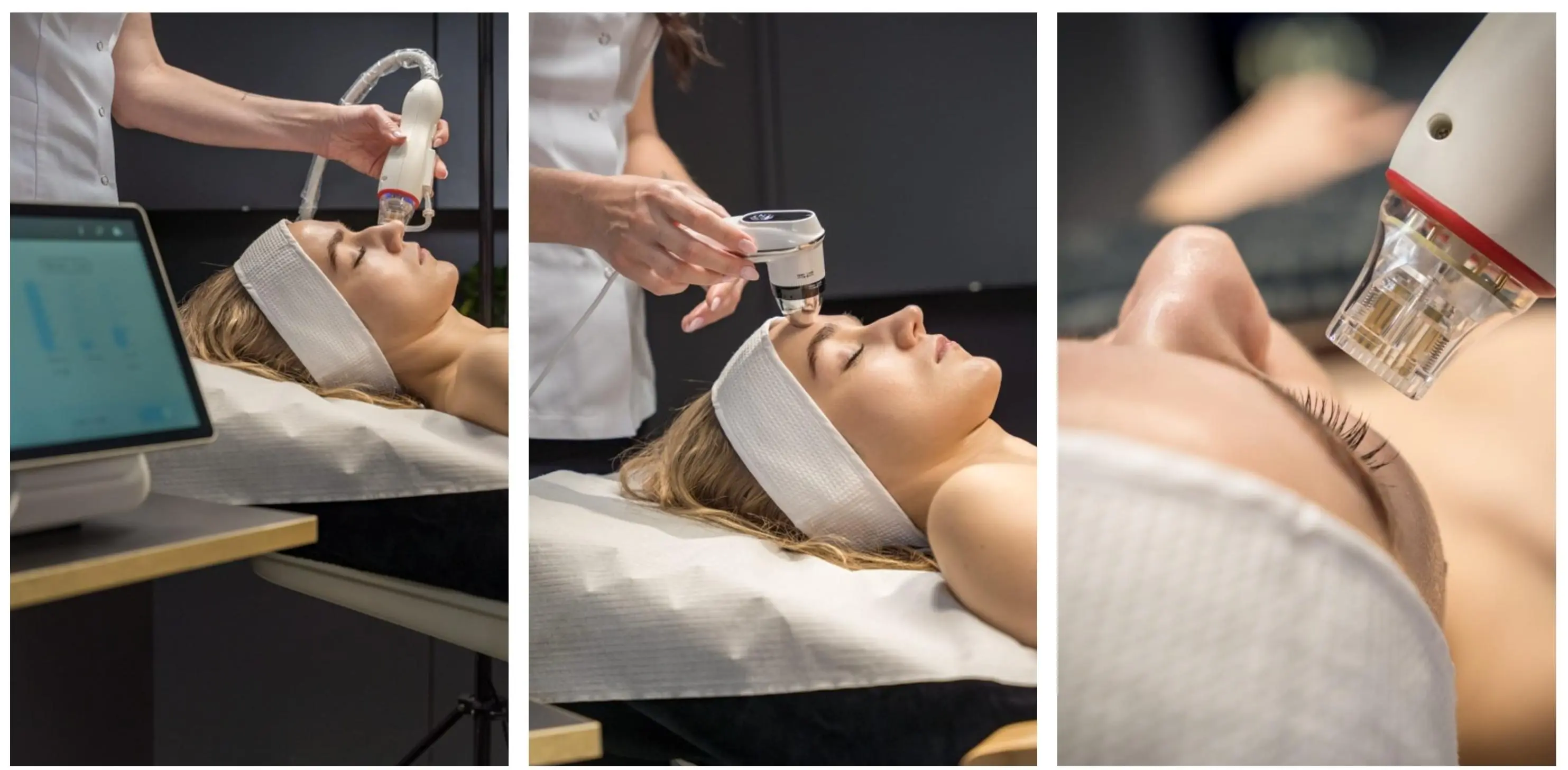 Fractional Resurfacing Solution Features