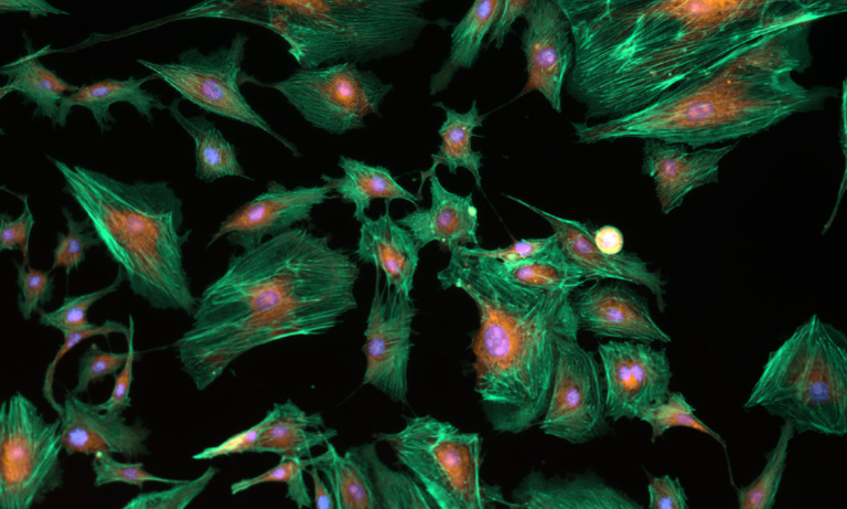 Fluorescence Microscopy
