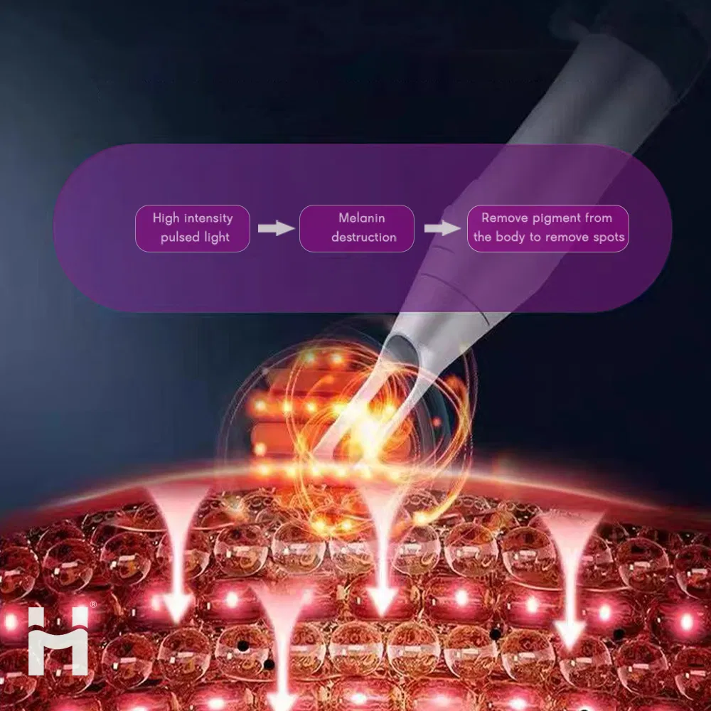 New Professional Picolaser Picosecond Laser 532nm 1064nm Q Switched ND YAG Laser Tattoo Removal Pico Laser Machine