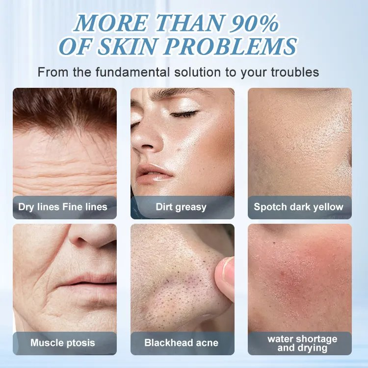 IPL Laser Therapy Hair Removal Skin Rejuvenation Blacken PRO Dpl Photofacial Skincare Device