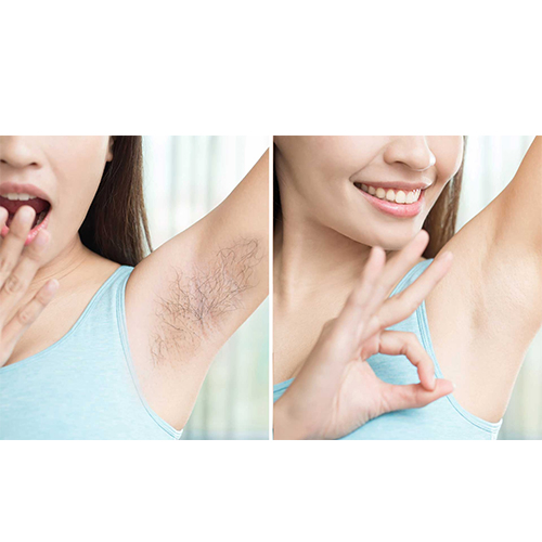 IPL Hair Removal Machine Skin Rejuvenation Machine Opt Laser System Painfree Hair Removal IPL Portable IPL Hair Removal