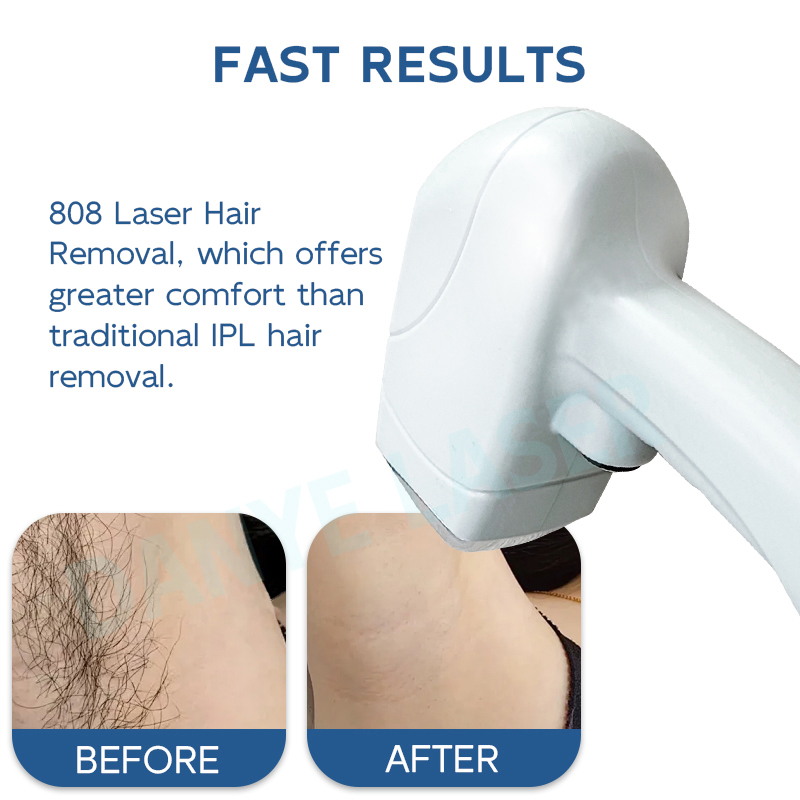 808nm Diode Laser Hair Removal Device with Water + Semiconductor Cooling