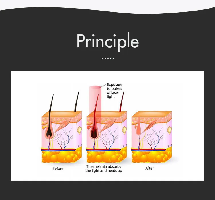 Technology Principle