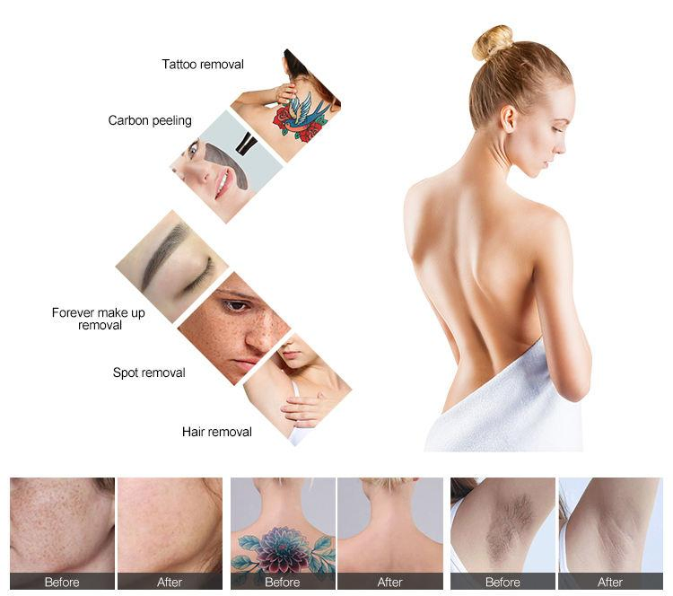 2024 New Arrival Vertical IPL Laser Hair Removal Skin Rejuvenation Acne Pigmentation Treatment Machine