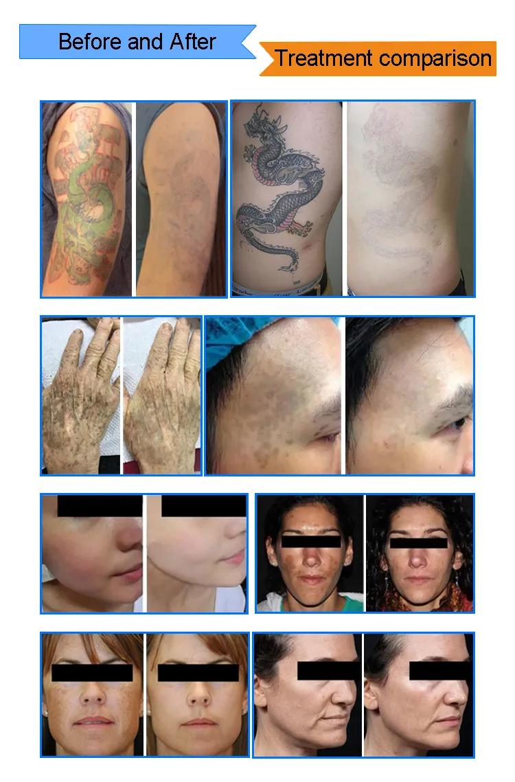 Treatment Applications