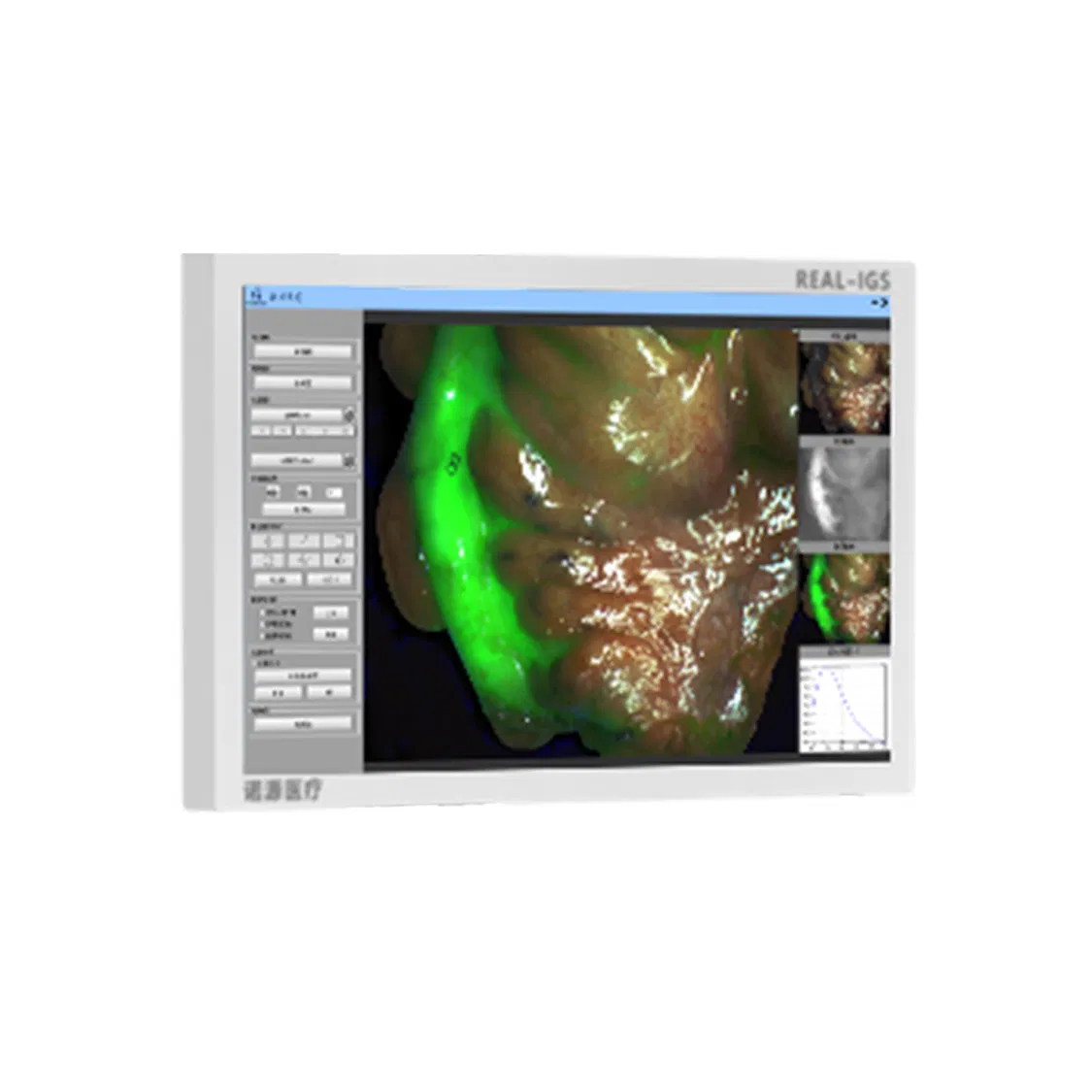 Advanced Professional Surgical Imaging System for Precise Diagnostics