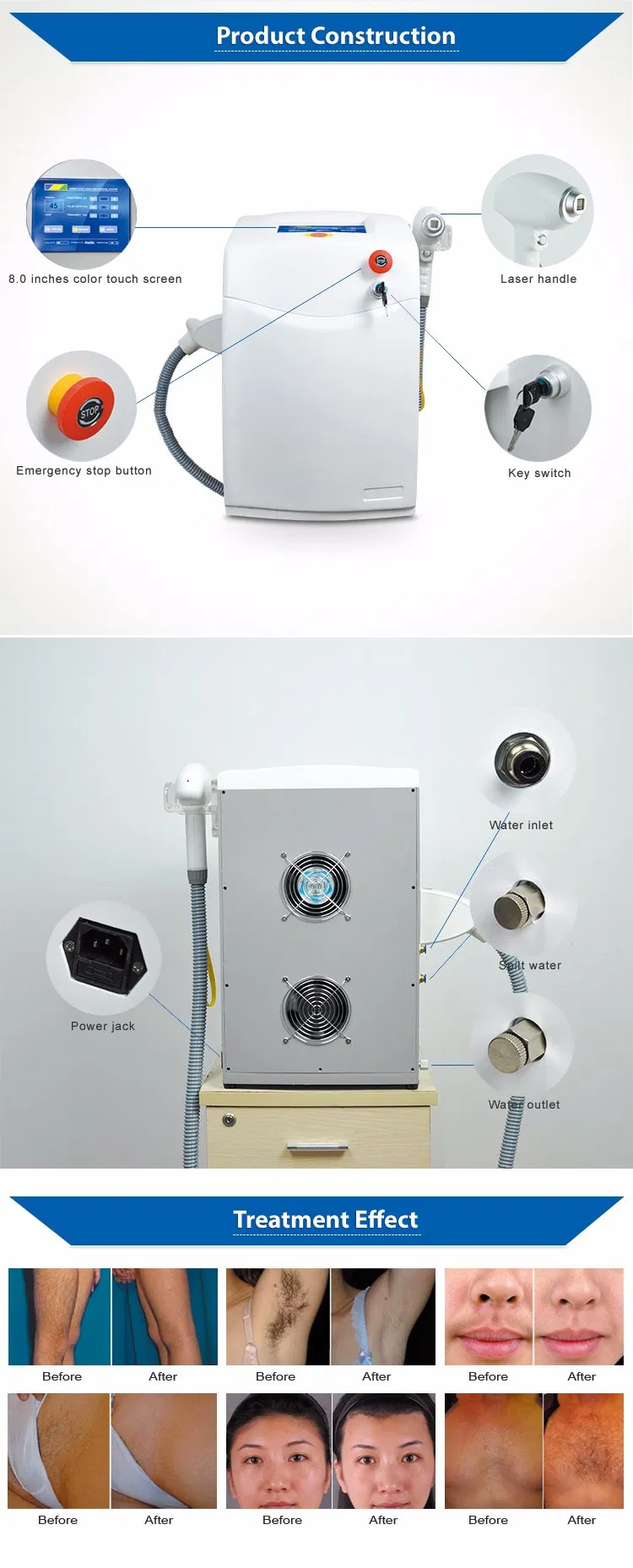 Diode Laser Device Detail 2