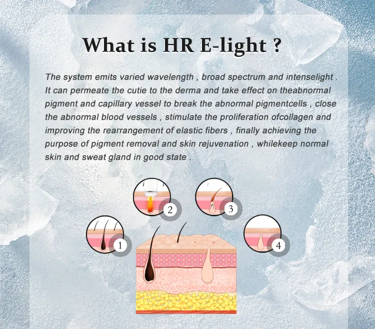 IPL Cooling Skin Rejuvenation