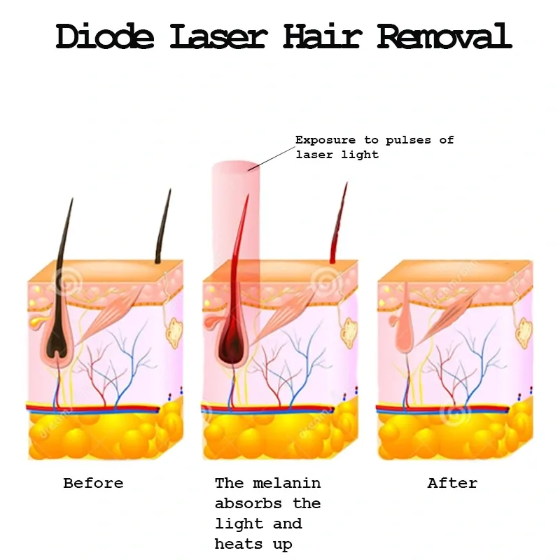Working Principle Diagram