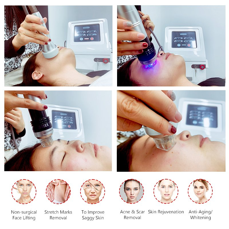 Fractional RF Microneedle Face Lift Rejuvenation Device