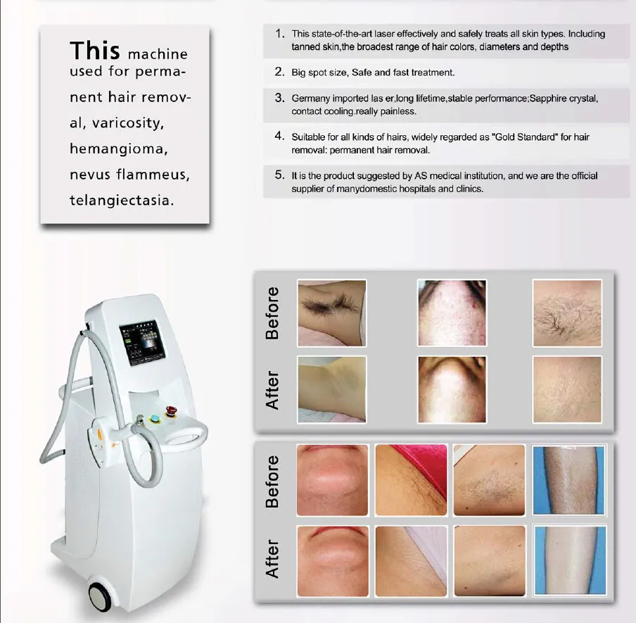 Diode Laser Treatment