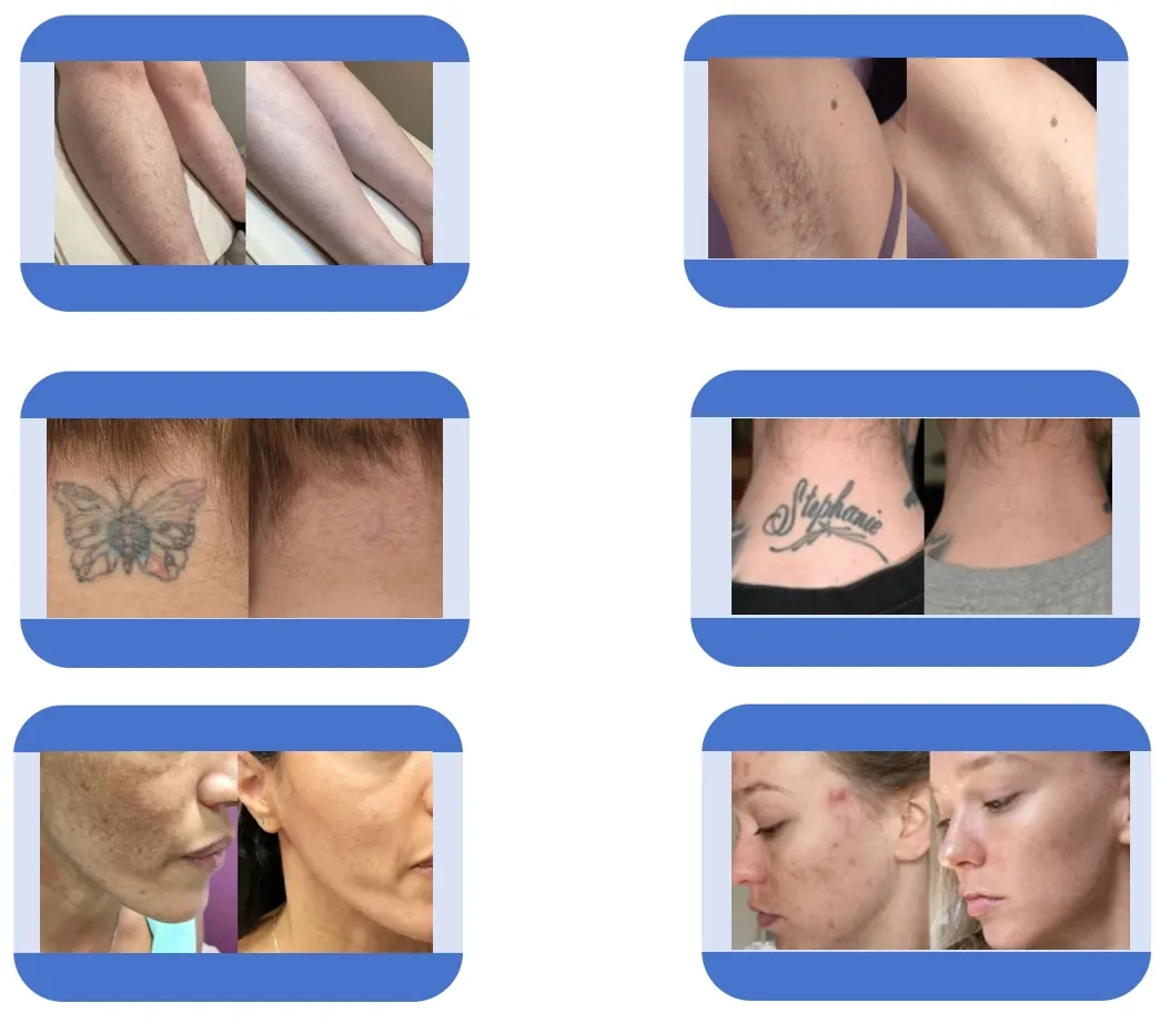 Before and After Results