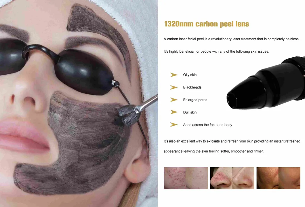 Cooling System Technology