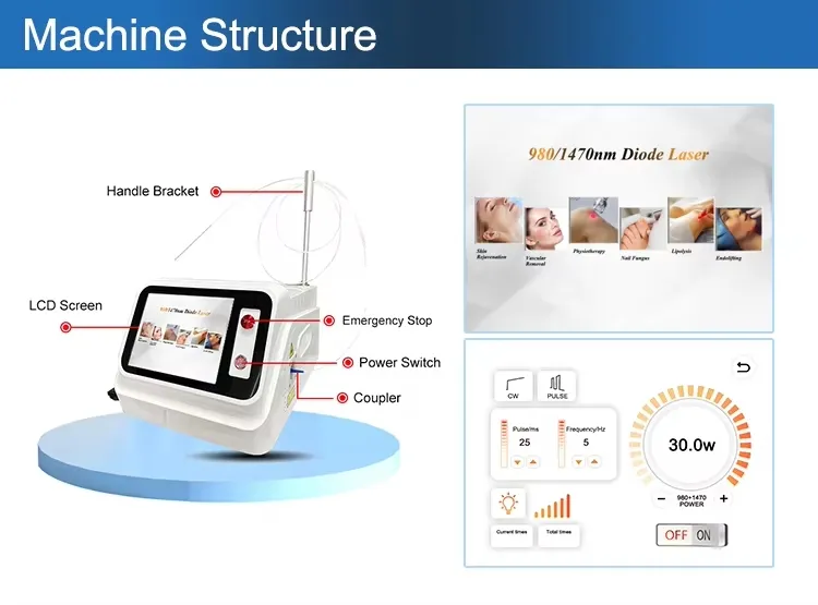 Laser Treatment Process