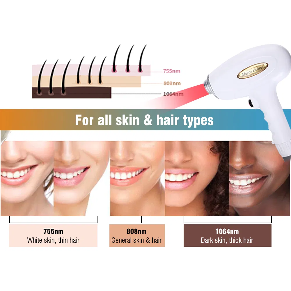 OEM Efficient 3 Wavelengths 755nm, 808nm, 1064nm 5 Million Shots Diode Laser Hair Removal Device