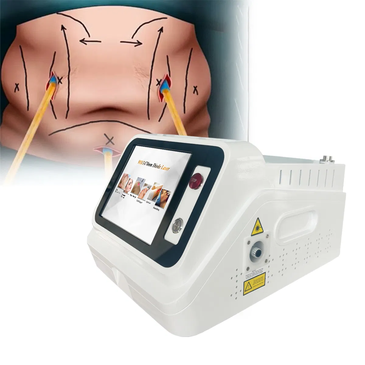 Portable 980 1470 Diode Laser Endolift Laser Face Lifting Ablation Therapy Laser Lipolysis Liposuction Machine