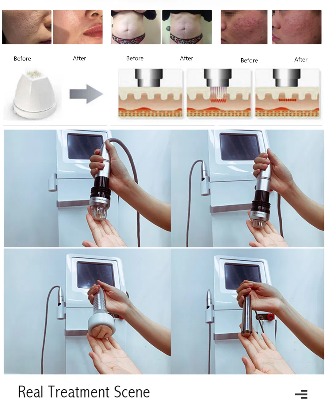 Technology Treatment